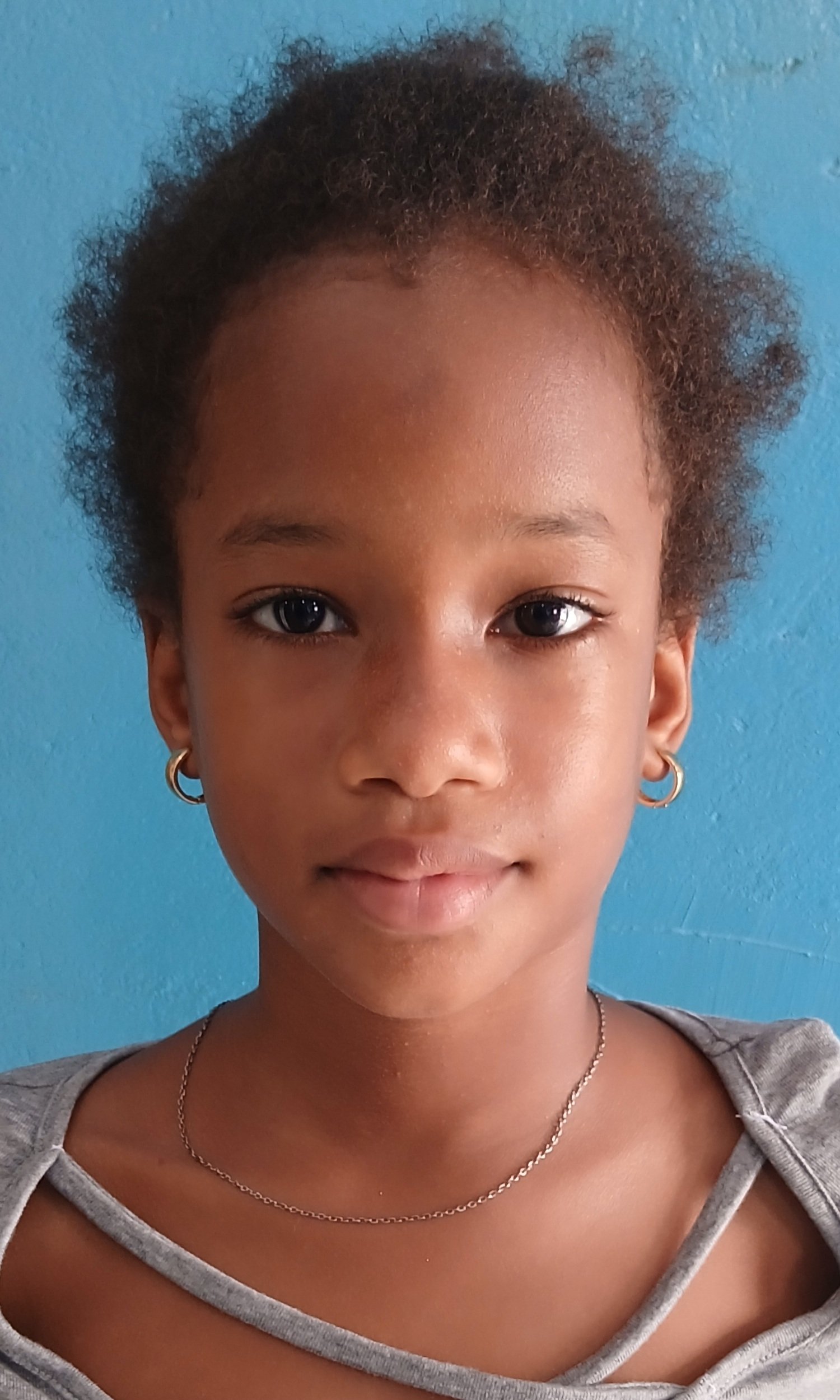 UMO CAND&Eacute; BALD&Eacute;